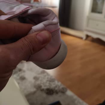Vicco Çocuk Ayakkabısının Kısa Sürede Açılma Sorunu Ve Değişim Talebi