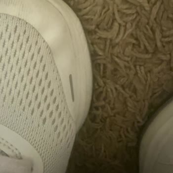 Skechers Ayakkabısında Üretim Hatası Ve Reddedilen İade Talebi