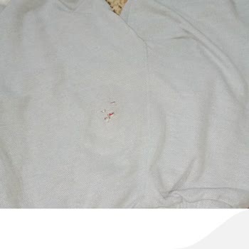Üç Gün Kullanımda Şortta Yırtık, Değişim Ve İade Talebim Reddedildi