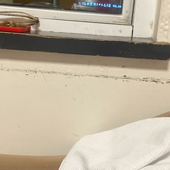 Balıkesir Nev Hastanesinde Doğum Odası Hijyen Sorunları Ve Aşırı Ücret