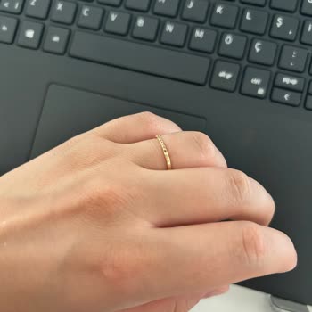 Yeni Yüzükte Taş Düşmesi Ve Müşteri Hayal Kırıklığı