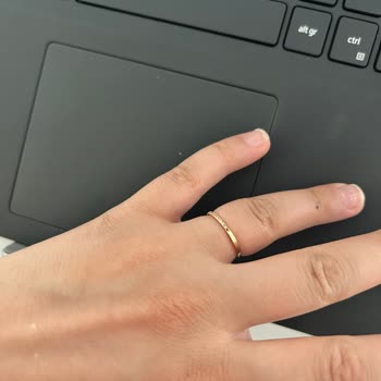 Yeni Yüzükte Taş Düşmesi Ve Müşteri Hayal Kırıklığı