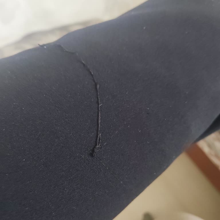 Kumaş Pantolonun Tiftiklenmesi Ve Müşteri Hizmetlerinden Geri Dönüş Olmamaması