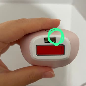 Philips Lumea Cihazının Tekrarlayan Arızası Ve İade Talebi