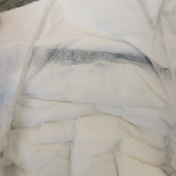 Bebek Bezinde Siyah Ve Sarı Lekeler: Hijyen Endişesi Ve Güven Sorunu