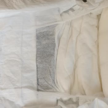 Bebek Bezinde Siyah Ve Sarı Lekeler: Hijyen Endişesi Ve Güven Sorunu