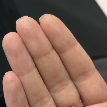 Media Markt'da Açtığım Braun IPL Cihazındaki Ayıplı Kıllar İade Reddi