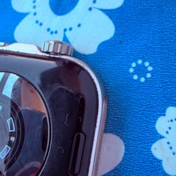 Huawei Watch Fit 5 Pro’da Kısa Sürede Kasa Oksitlenmesi Ve Garanti Reddi