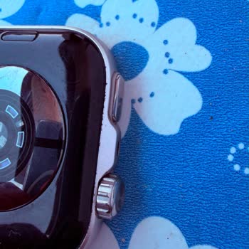 Huawei Watch Fit 5 Pro’da Kısa Sürede Kasa Oksitlenmesi Ve Garanti Reddi