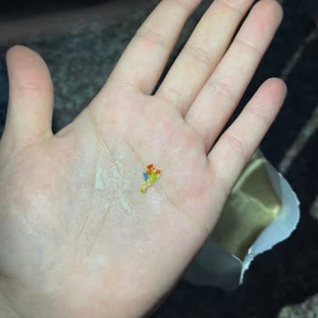 Bebek İçin Satın Alınan Ürün İçinde Plastik Parçacıklar Ve Böcekler Bulundu