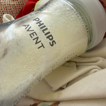 Avent Cam Biberonda Yoğun Gaz Ve Kusma Sorunu: Değişim Veya İade Talebi