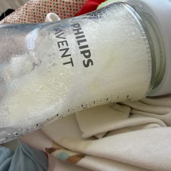 Avent Cam Biberonda Yoğun Gaz Ve Kusma Sorunu: Değişim Veya İade Talebi