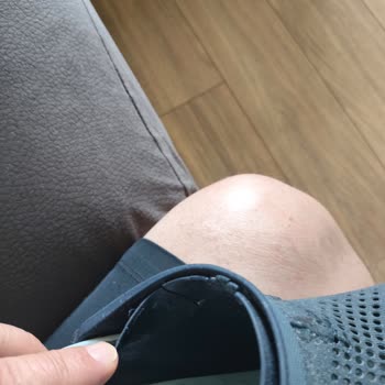 Crocs Terlik Sorunu