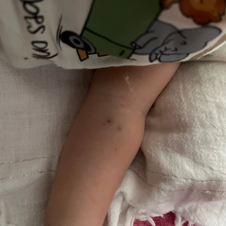 Çocuğumun Kan Alımında Hemşire İğne Hatası Ve Umursamaz Tavır