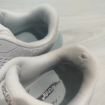 Sadece On Beş Kez Kullanılan Skechers Ayakkabıda İç Bilek Delinmesi Ve Para İadesi Talebi