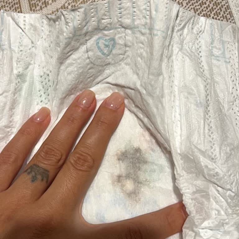 Bebek Bezinde Siyah Yabancı Cisim Lekesi Ve Hijyen Endişesi