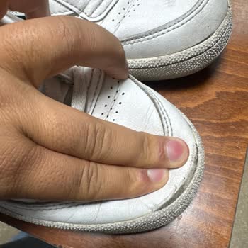 Reebok Ayakkabısının 5 Ayda Yırtılması Ve İade Reddi