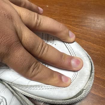 Reebok Ayakkabısının 5 Ayda Yırtılması Ve İade Reddi