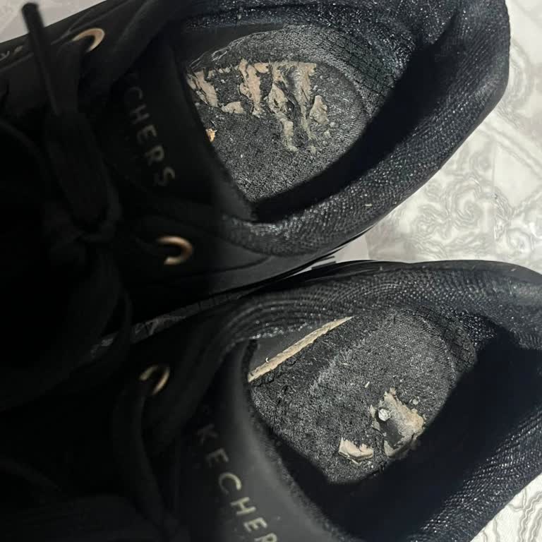 Skechers Modelinde Kısa Sürede Topuk Aşınması Ve Garanti Reddi
