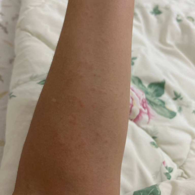 Asperox Sarı Güç Ürünü Alerjik Reaksiyon Ve Yetersiz Uyarı