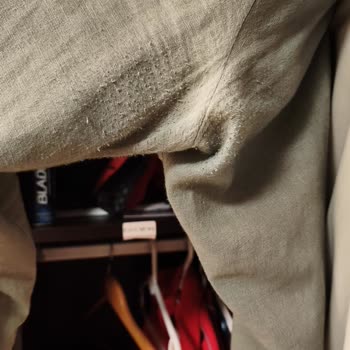 Pantolonun Kısa Sürede Yıpranması Ve İade Sürecindeki Gecikme