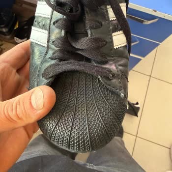 Adidas Superstar Ayakkabısının Kısa Sürede Patlaması Ve Haksız Ret Kararı