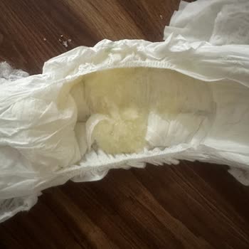 Hatalı Sleepy Bezlerde Tek Paket Teklifi Yetersiz