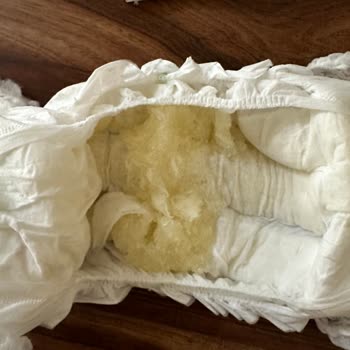 Hatalı Sleepy Bezlerde Tek Paket Teklifi Yetersiz