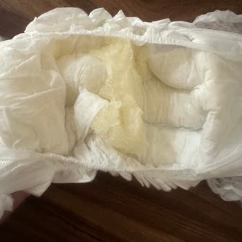 Hatalı Sleepy Bezlerde Tek Paket Teklifi Yetersiz
