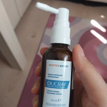 Saç Dökülmesinde Artış Ve Şirketin Cevapsızlığı