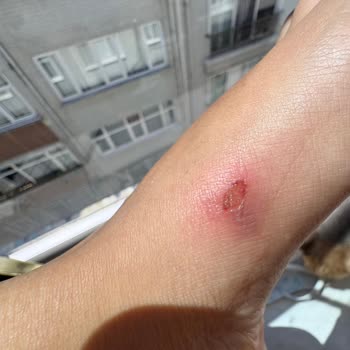 Elle AVM'de Satın Alınan Terlik Ayağımı Yaraladı, Çanta Koptu