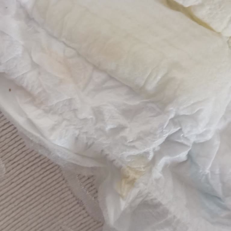 Molfix Size 5 Diapers Leaking Due To Defective Absorbent Core
