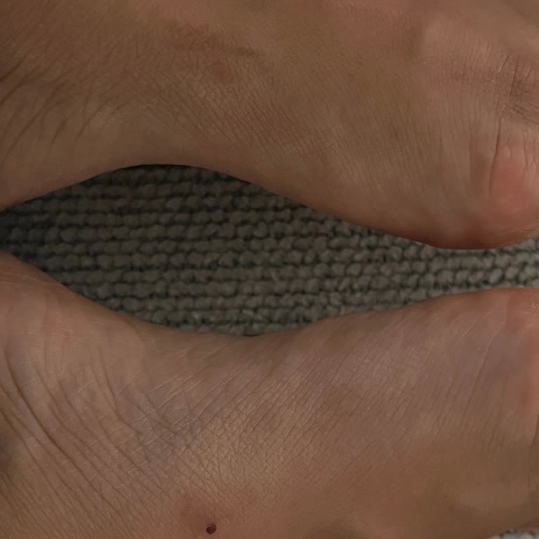 Derimod Terliği Ayağımı Kesti, Değişim Talebim Reddedildi