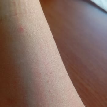 A101'den Alınan Lay’s Karidesli Cipste Yetersiz Alerjen Uyarısı