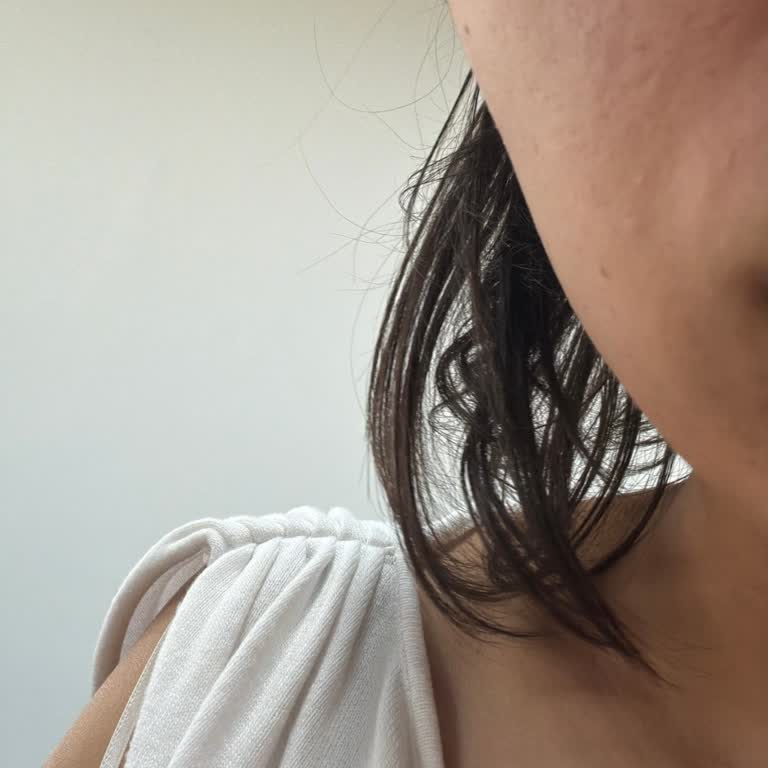 Bioderma Sébium Hydra Ciltte Yanma, Kızarıklık Ve Akne Şikayeti