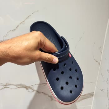 A101’den Satın Alınan Crocs Terlikte Hızlı Renk Değişimi Ve İade Sürecinde Destek Bulunamaması