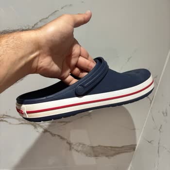 A101’den Satın Alınan Crocs Terlikte Hızlı Renk Değişimi Ve İade Sürecinde Destek Bulunamaması