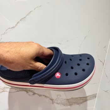 A101’den Satın Alınan Crocs Terlikte Hızlı Renk Değişimi Ve İade Sürecinde Destek Bulunamaması
