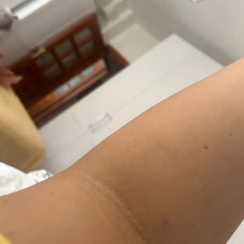 Acil Serviste Alaycı Hemşire Davranışı Ve Damar Açılmaması