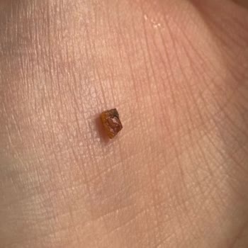 Kahve Dünyası Gofrik’te Sert Parça Bulunması Diş Ağrısına Yol Açtı