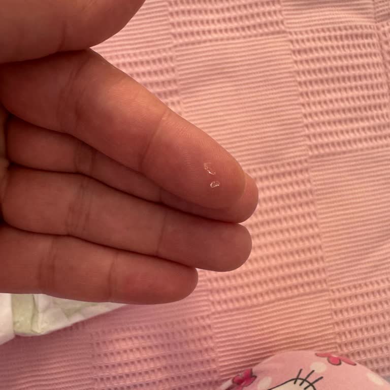 Bebek Bezindeki Jel Sızıntısı Ve Güvenlik Sorunu