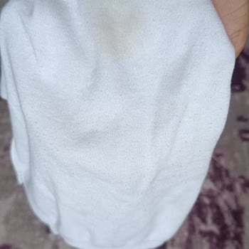 Vestel Çamaşır Makinem Kirli Yıkıyor Ve Kıyafetlerimi Yırtıyor, Servis Sorunu Çözmüyor
