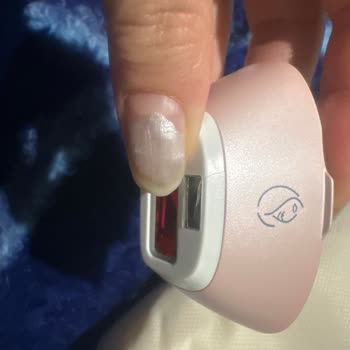 Philips Lumea Cihazı Aşırı Isınıyor Ve Yüz Başlığı Çatladı