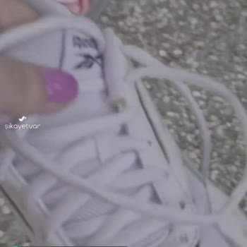 Reebok Spor Ayakkabı Deformesi