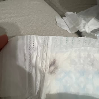 Prima Aktif Bebek Bezinde Böcek Koza Ve Kum Kıvamı Bulunması