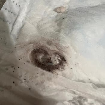 Prima Aktif Bebek Bezinde Böcek Koza Ve Kum Kıvamı Bulunması