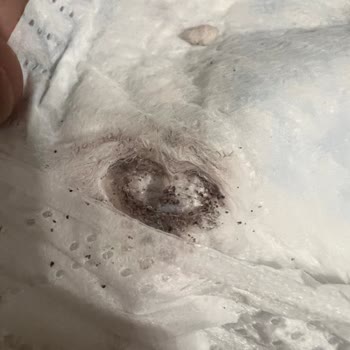 Prima Aktif Bebek Bezinde Böcek Koza Ve Kum Kıvamı Bulunması