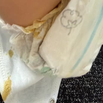 Prima Aktif Bebek Bezlerinde Kalite Düşüşü Ve Sızdırma Sorunu