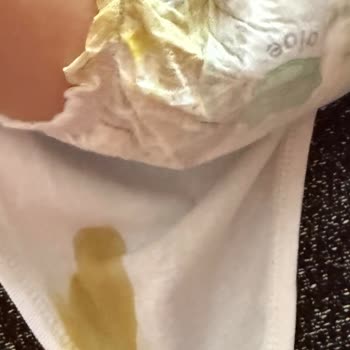 Prima Aktif Bebek Bezlerinde Kalite Düşüşü Ve Sızdırma Sorunu