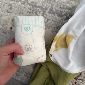 Prima Aktif Bebek Bezlerinde Kalite Düşüşü Ve Sızdırma Sorunu